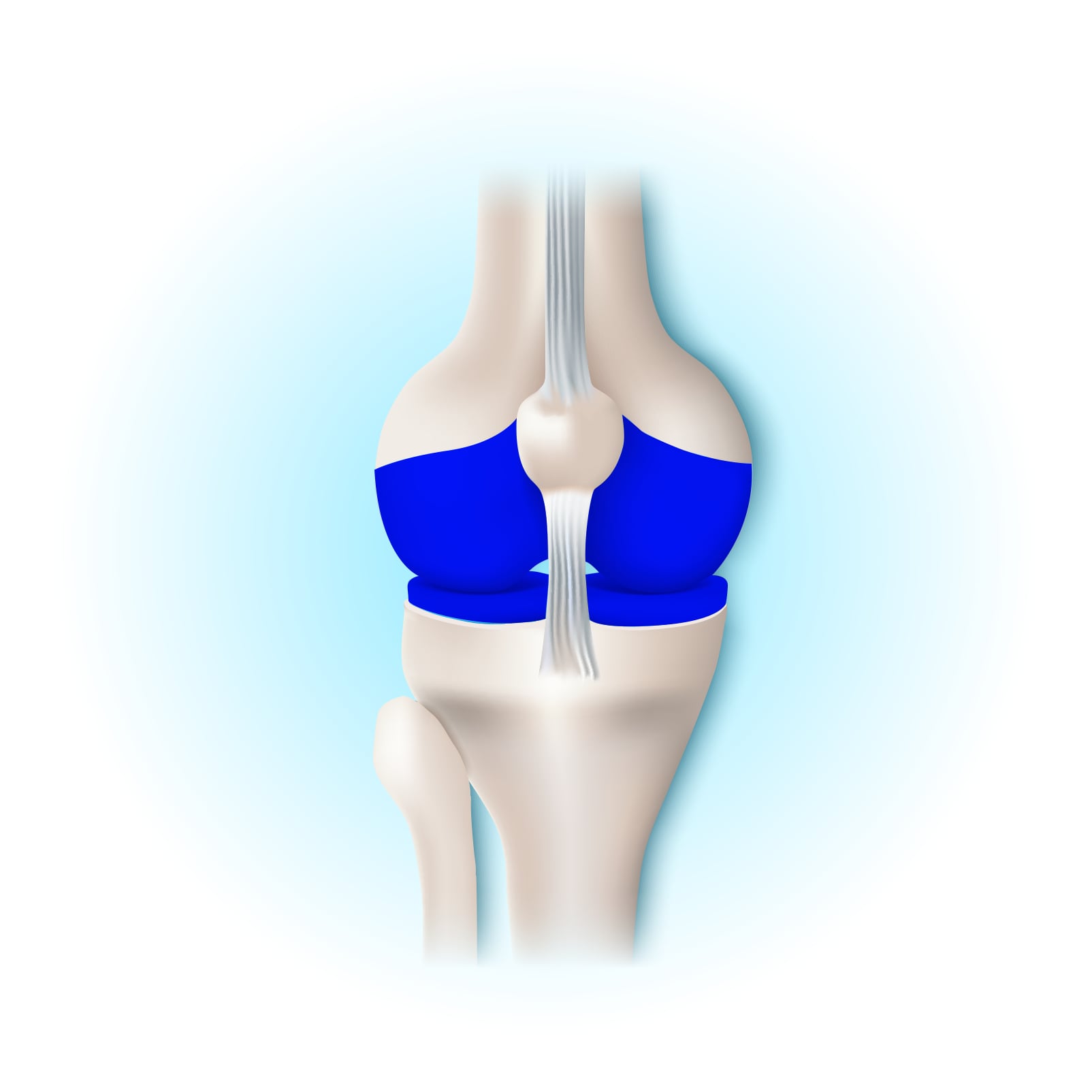 Natural Pharmaceuticals Movisan™ Collagen II Térdízület ábrázolása, kék porcfelületekkel és szalagokkal, anatómiai szerkezet részletezése.